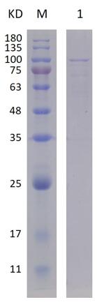 12% SDS-PAGE analysis profiles of purified MCR_RS05925-25-818 (CBB stained).